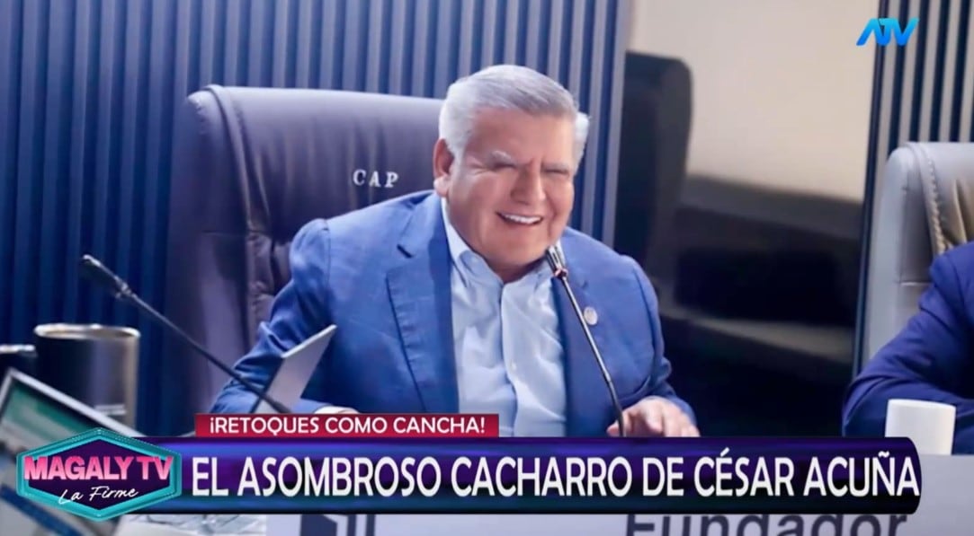 ¿Qué se habría hecho César Acuña en el rostro? Magaly Medina reacciona y especialistas analizan su apariencia. Captura: Magaly TV La Firme.