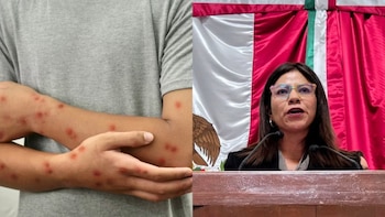 Sarampión en CDMX: Congreso descarta