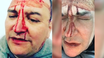 La Justicia ya investiga el