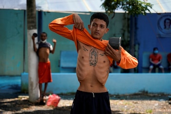 Un recluso muestra su estado