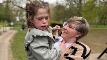 Nació con el corazón fuera