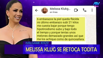 Melissa Klug revela sus cirugías: