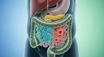 Ilustración de órganos internos del torso: hígado, estómago, páncreas, intestino delgado y grueso, con microorganismos azules y rojos.