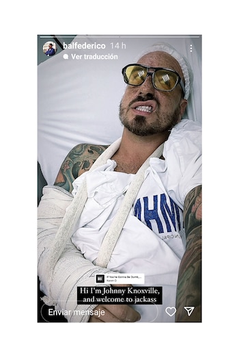 Fede Bal horas después de