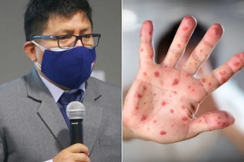 Minsa confirma el primer caso