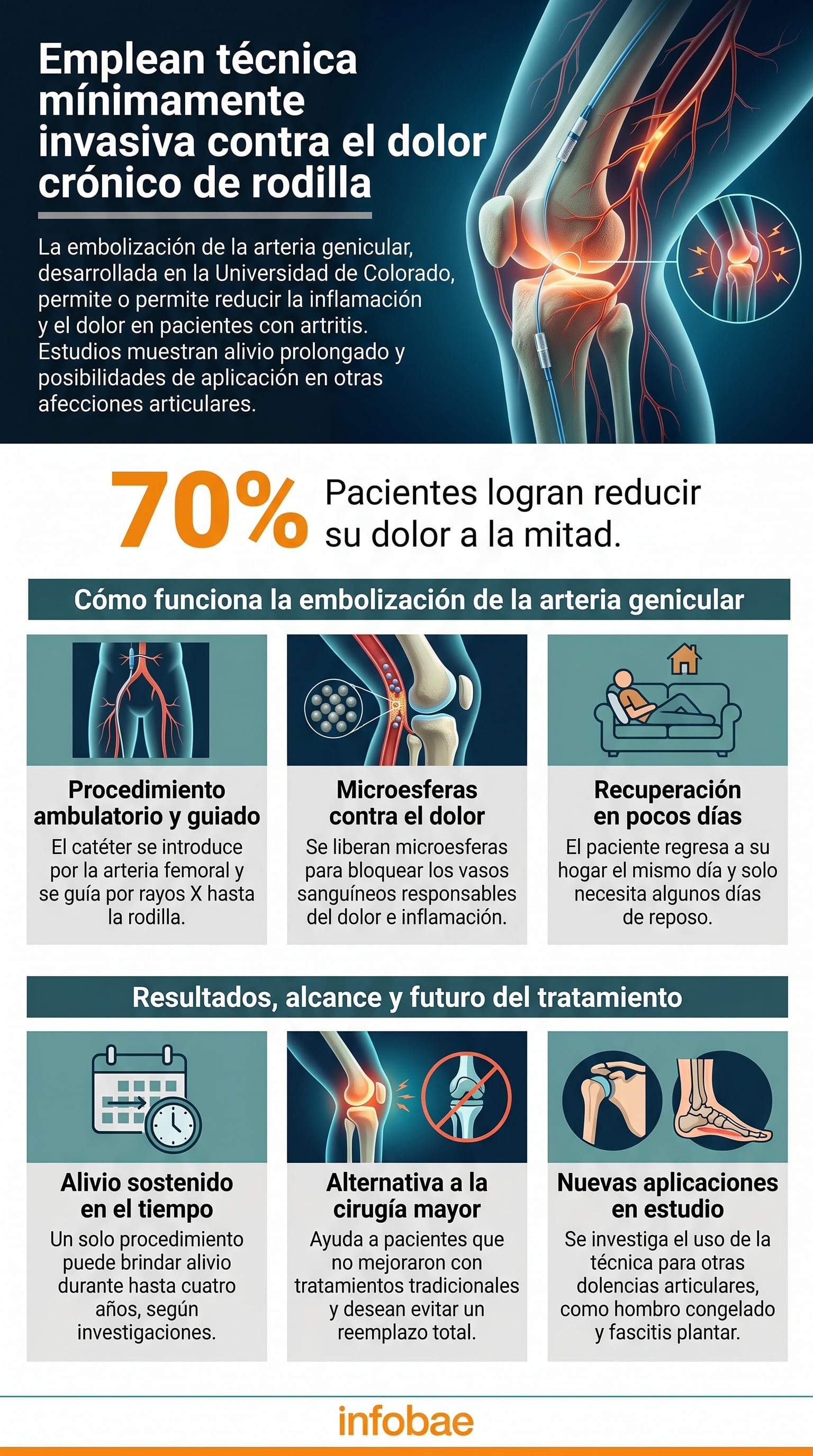 La embolización de la arteria genicular, desarrollada por la Universidad de Colorado, reduce el dolor crónico de rodilla en el 70% de los pacientes y se postula como alternativa a la cirugía mayor. (Imagen Ilustrativa Infobae)