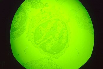 Virus de la peste porcina