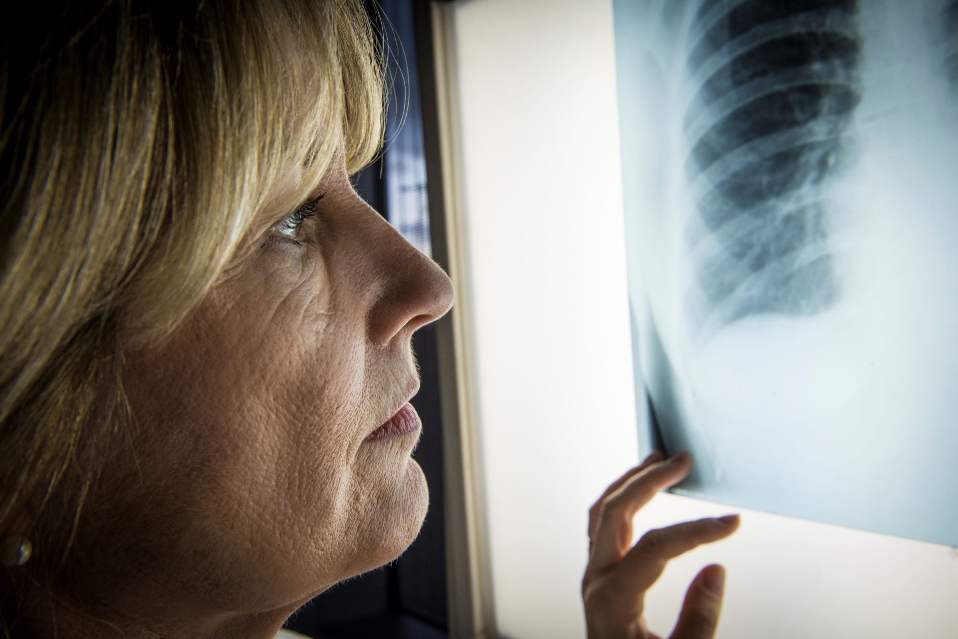 La prevención, el diagnóstico oportuno y el tratamiento temprano de enfermedades respiratorias salvan vidas (AstraZeneca)