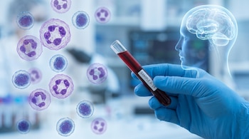 Mano enguantada sostiene tubo de ensayo de sangre etiquetado 'SAMPLE A-14'. Células sanguíneas flotantes y una silueta transparente de cabeza con cerebro en el fondo.