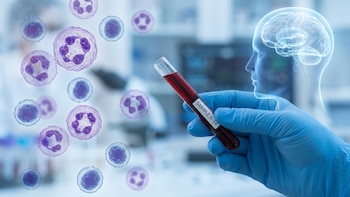 Cómo un análisis de sangre y el rol del sistema inmune podrían anticipar el riesgo de alzhéimer