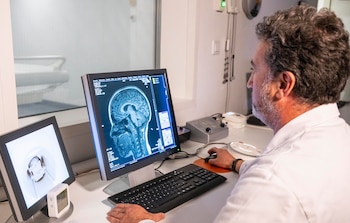 La migraña se caracteriza por