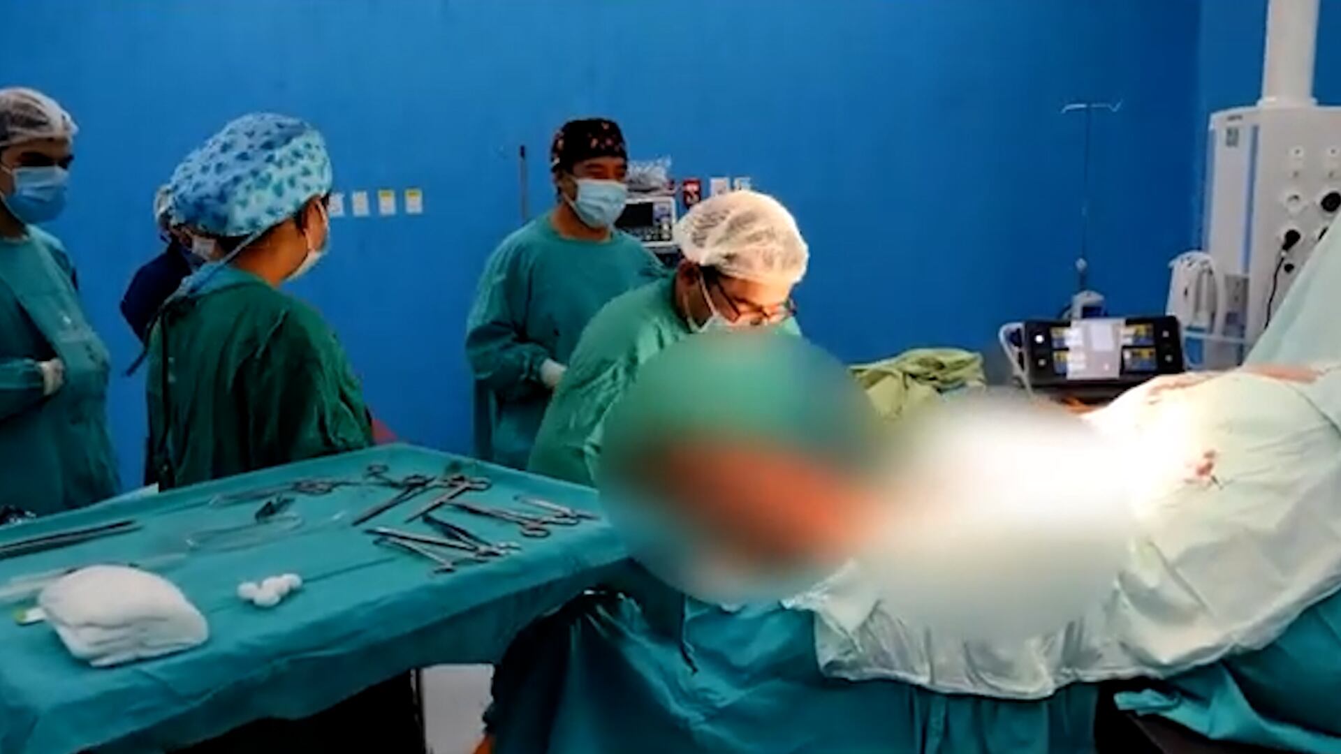 El procedimiento, cubierto por el Sistema Único de Salud, permitió extraer más de 40 kilogramos de tejido tumoral que impedían el desplazamiento del paciente (Captura de video: YouTbe)