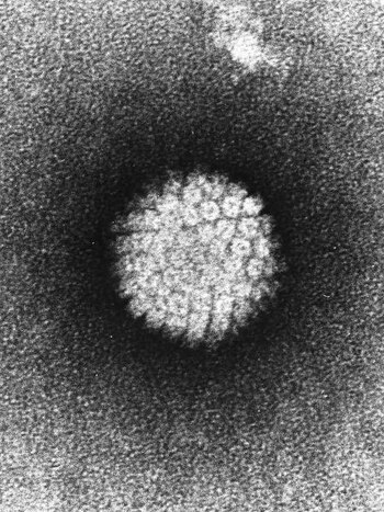 09-06-2010 Virus del papiloma, VPH
REINO