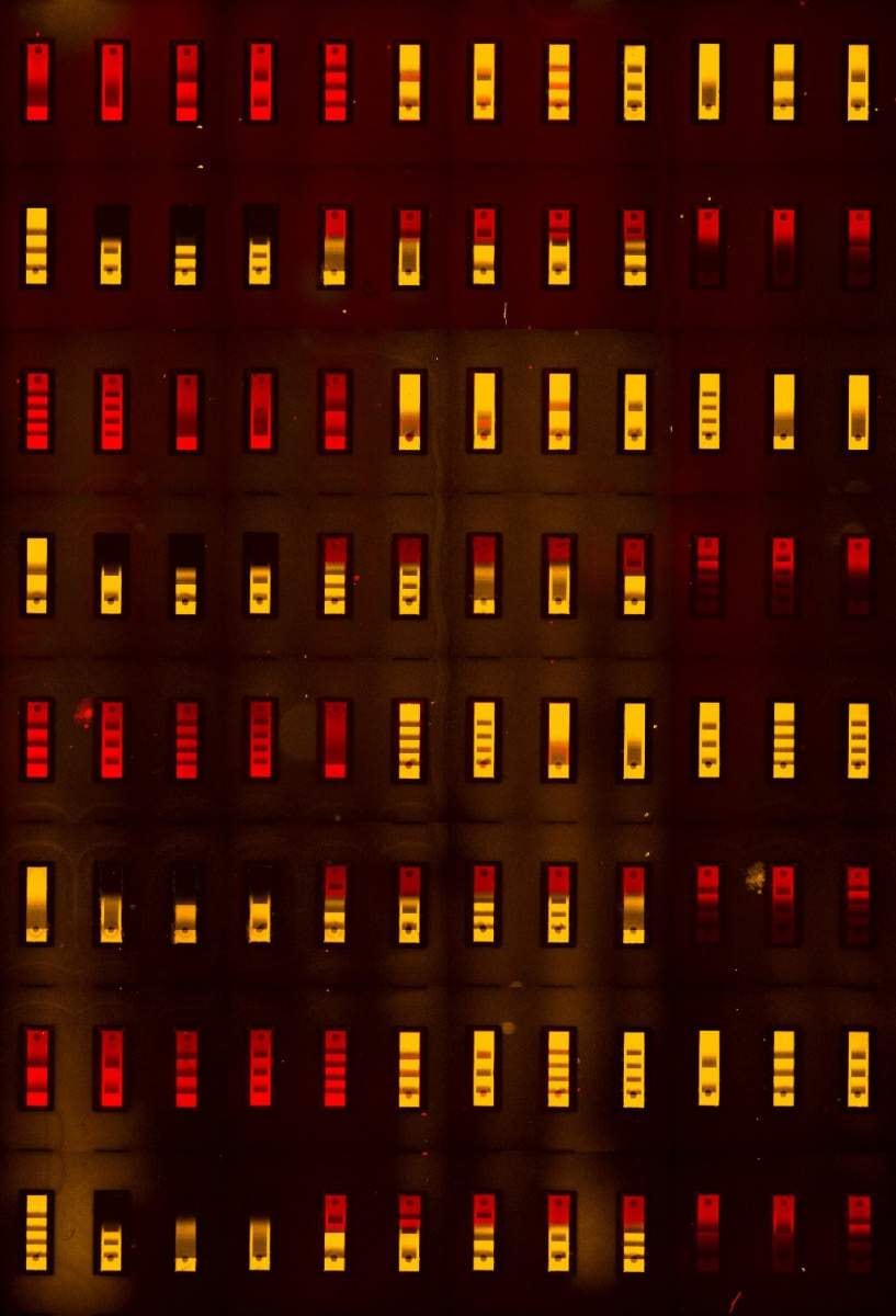 Una imagen de microscopio de fluorescencia del biochip con sus numerosos compartimentos minúsculos, cada uno de los cuales presenta un antígeno diferente, lo que hace posible probar simultáneamente las interacciones de todos estos antígenos con un anticuerpo humano
