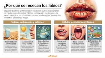 Infografía con labios resecos, texto "¿Por qué se resecan los labios?", seis ilustraciones de causas como deshidratación, sol, bálsamos, lamer labios, boca seca, vitaminas.