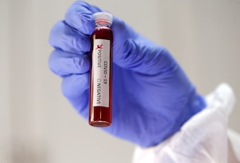 Los nuevos virus logran con una eficiencia aterradora su único objetivo: infectar a la mayor cantidad posible de seres vivientes sin exterminar a todos, porque les son vitales para multiplicarse (REUTERS)