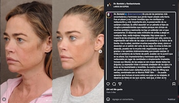 El doctor Ben Talei explicó