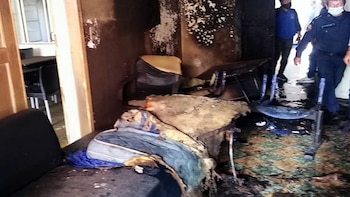 Hombre sufrió quemaduras en el