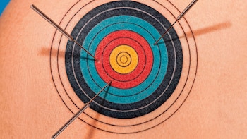 ¿La punción seca realmente alivia el dolor?