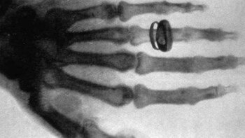 La primera radiografía de la