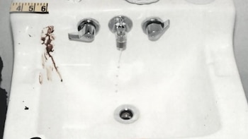 Lavabo de baño blanco con tres grifos metálicos, agua goteando del grifo central, desagüe, manchas rojizas en el lado izquierdo y regla de medición en la parte superior