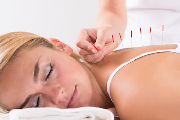 La Organización Mundial de la Salud recomienda la formación formal de acupuntores para integrar esta terapia de manera segura en los sistemas de salud (Shutterstock)