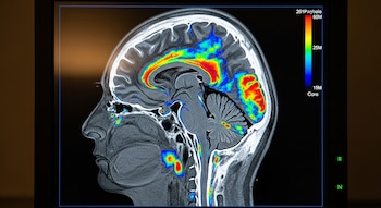 Los expertos advierten sobre las