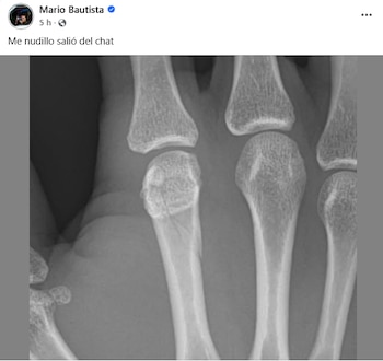 La derrota en menos de tres minutos sorprendió a los asistentes
(Facebook)