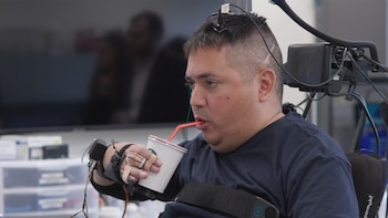 Un implante cerebral ayudó a un hombre con parálisis a mover la mano: cómo funciona el doble bypass neural