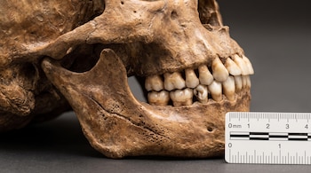 Primer plano lateral de un cráneo fósil con su mandíbula. El hueso tiene una textura áspera y dientes visibles. A la derecha, una regla de medición.