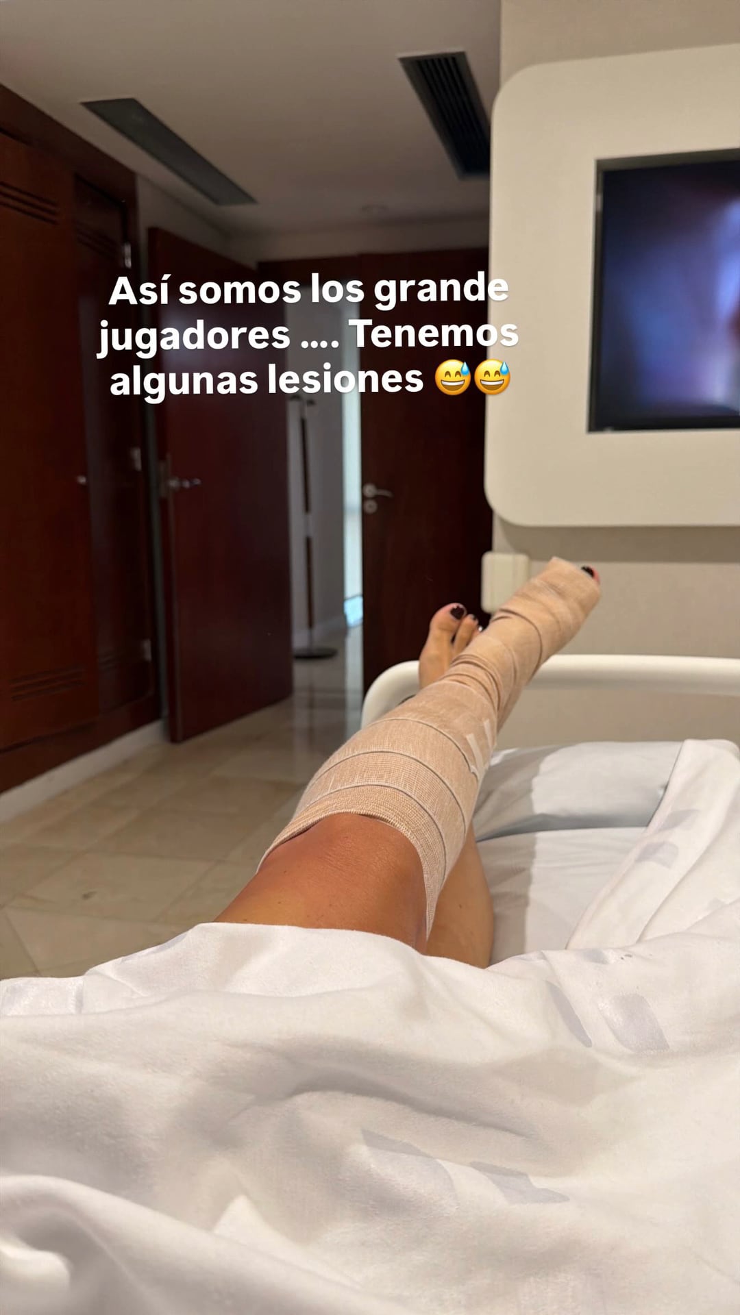 Zulemita Menem, hija del expresidente Carlos Menem, compartió una imagen de su pierna vendada en redes sociales tras someterse a una operación, informando sobre su estado de salud y rehabilitación.