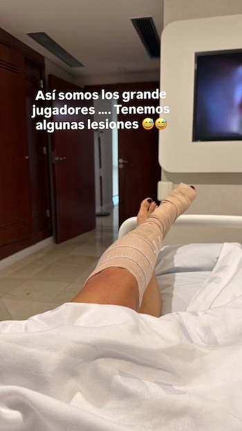 Primer plano de la pierna de una persona, con la pantorrilla y el pie envueltos en un vendaje color piel, acostada en una cama de hospital