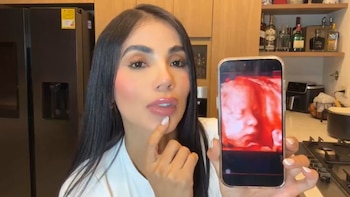Karina García sorprendió al revelar que su bebé presenta una condición inesperada: “No es normal”