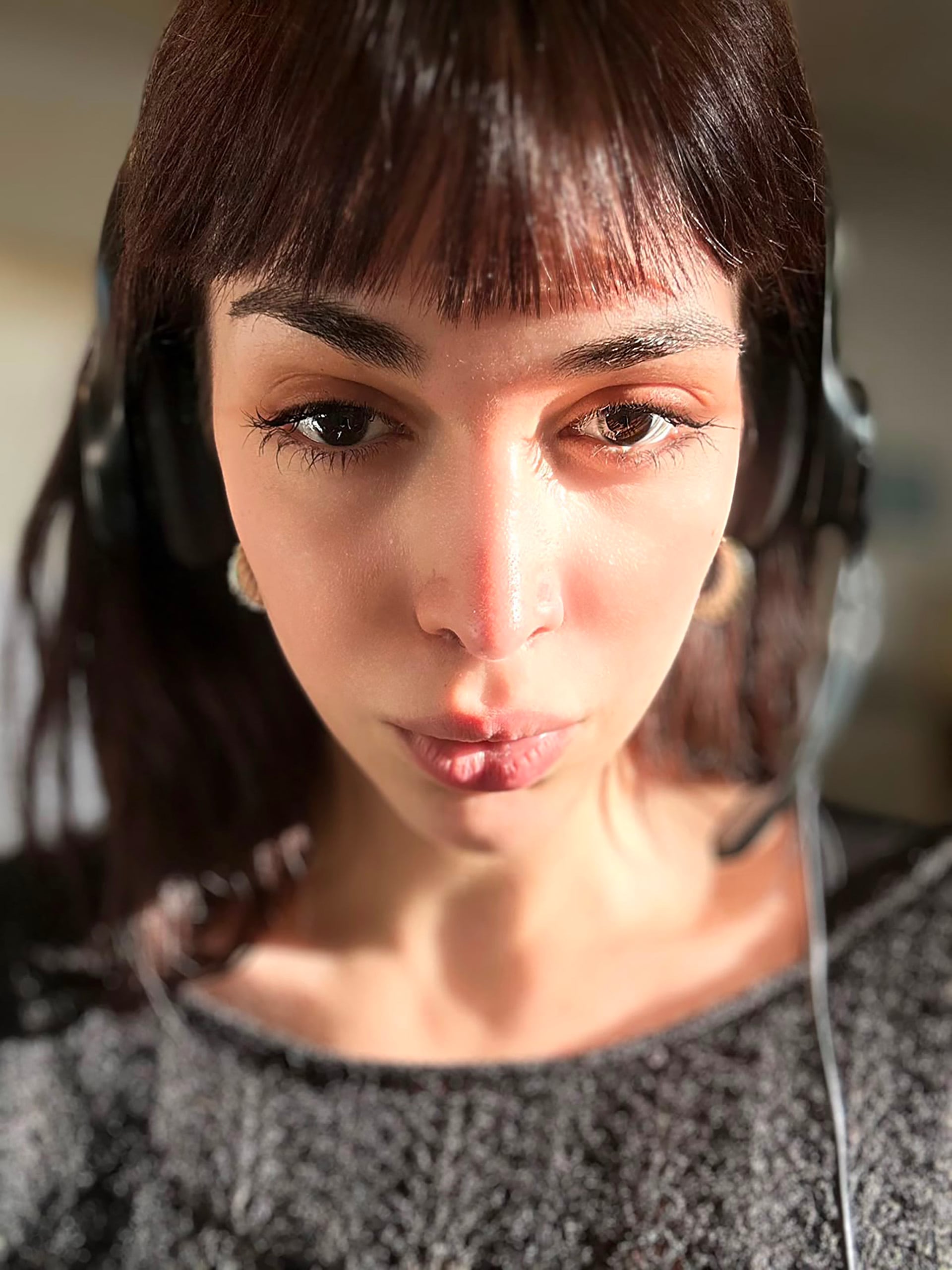 La vaginoplastia trabaja con el tejido existente. Los testículos se retiran porque no tienen función en la nueva anatomía (@martinabellucciok)