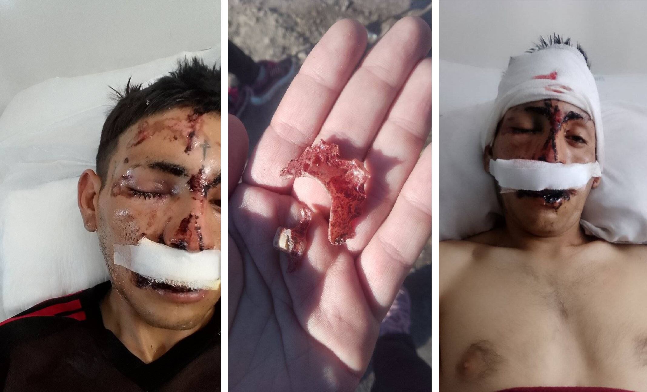 La víctima fue atacada cuando salió a comprar alimentos para desayunar con su hijo en la localidad de Libertad en Merlo