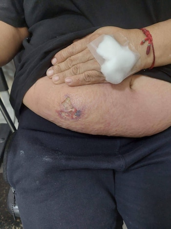 La paciente permanece aislada en