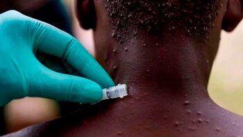 Bogotá tiene el 75% de