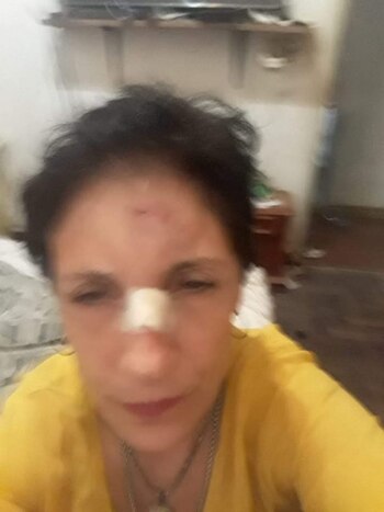 Secreto registró con fotos los