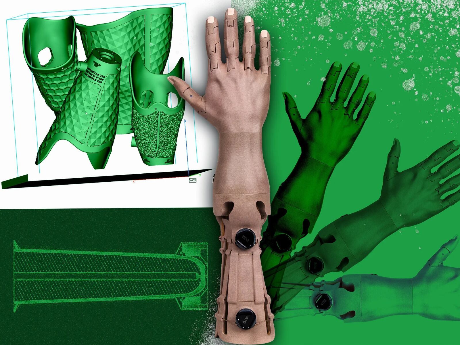 La durabilidad de las prótesis impresas en 3D genera dudas frente a los modelos convencionales en clínicas internacionales (Unlimited Tomorrow)