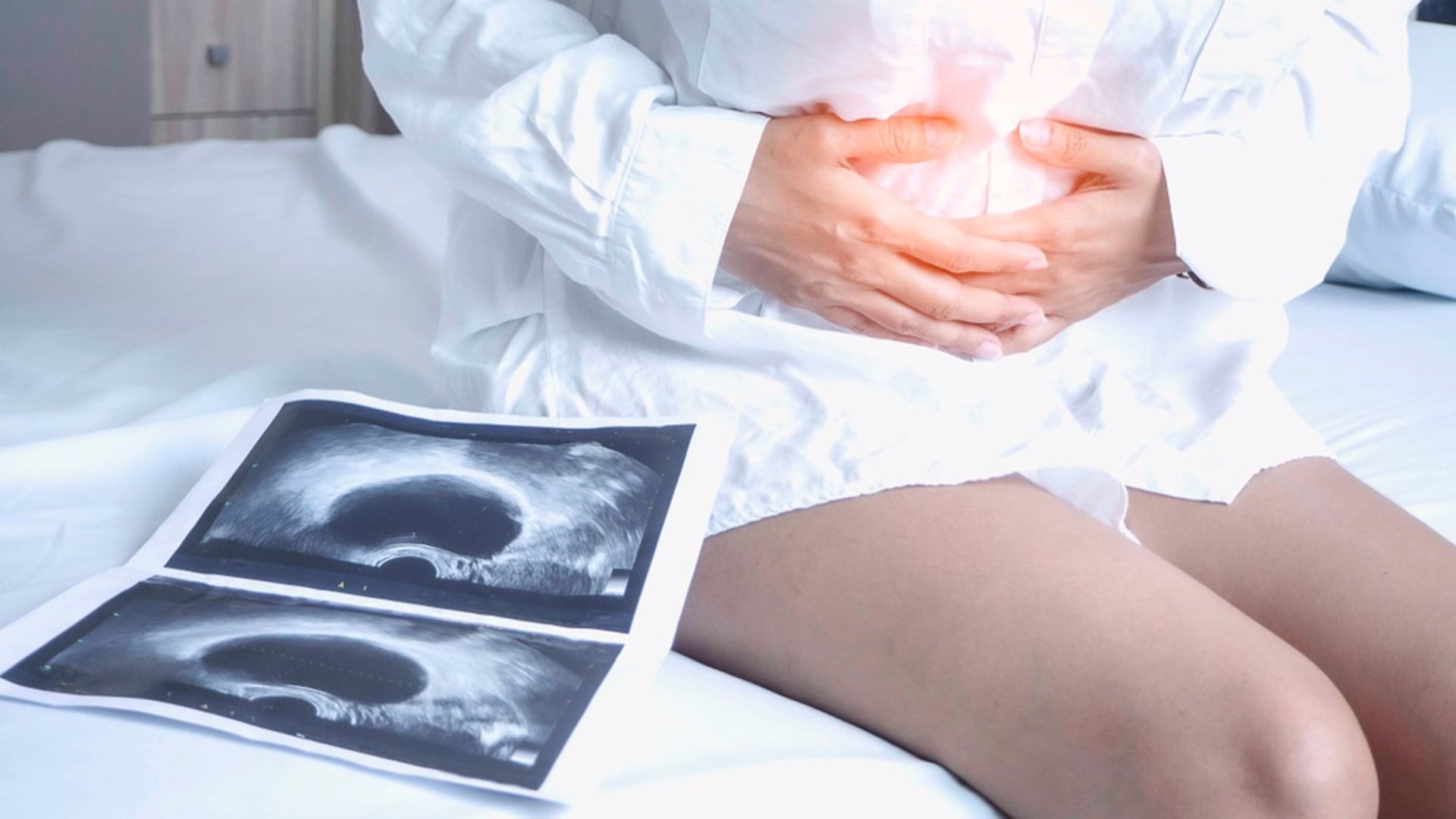 Un estudio de Mayo Clinic reforzó que las trompas de Falopio son el origen más frecuente del subtipo más agresivo de cáncer de ovario (Europa Press)