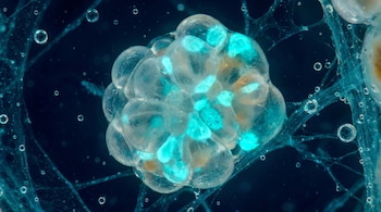 Un cúmulo celular esférico y translúcido con núcleos luminosos de color cian, rodeado por fibras de andamiaje y diminutas burbujas en fondo azul.