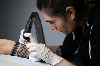 Los linfomas se manifiestan comúnmente