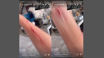 Nataly Umaña preocupó por ataque