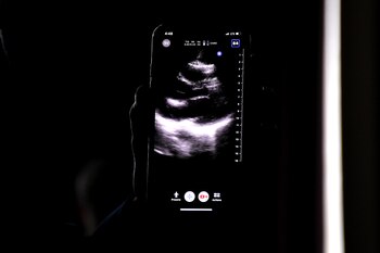 Desde su presentación en 2018,