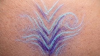 Plano macro de piel humana con líneas luminosas de color azul y violeta en forma de V y espirales.