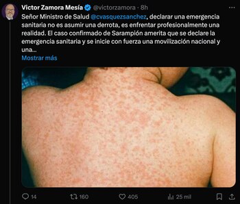 Exministro de Salud sugirió medidas