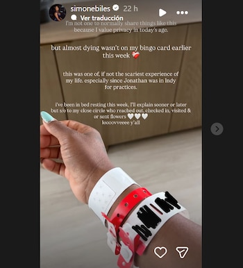 Primer plano del brazo y la mano de Simone Biles. Su muñeca lleva varias pulseras de hospital blancas y rojas, algunas con información censurada en negro. Uñas celestes