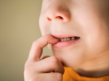 El proceso de caída de los dientes de leche comienza a los 6 años (Magnific)