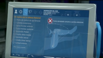 Un sistema robótico busca mejorar la precisión en prótesis de rodilla y cadera (Cortesía CCSS)
