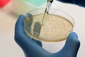 Placa de Petri de bacteria Bacillus cereus (UMA)